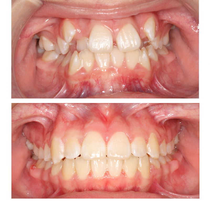 Orthodontics in Anaheim Hills